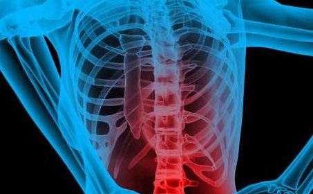 causes of upper and lower back pain are often related to workplace ergonomics